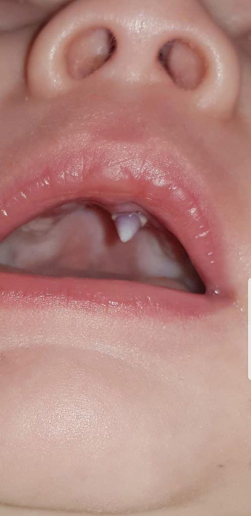 NINTCHDBPICT000443198464