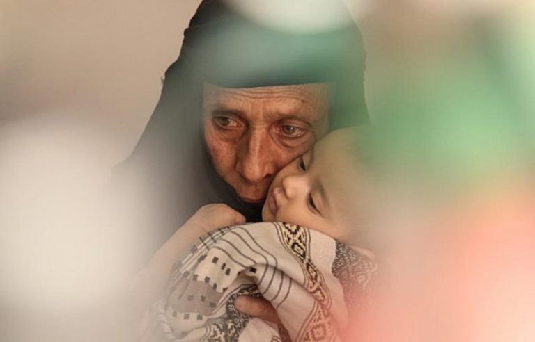 Yemen se enfrenta a la peor hambruna desde la I Guerra Mundial