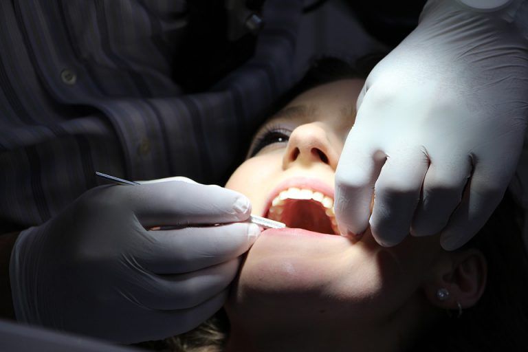Implantes Cigomáticos: Qué Son, Cómo Funcionan y Cuándo Optar por Ellos