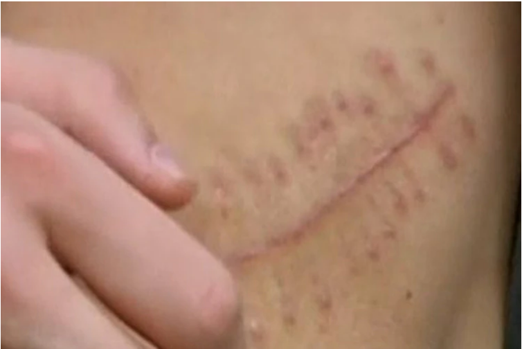 Un joven hospitalizado tras vender su riñón para comprar un iPhone