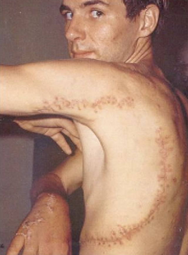 Los 5 ataques de tiburón más salvajes registrados en la historia (imágenes sensibles) 5 Captura de pantalla 2019 07 18 a las 20.13.59