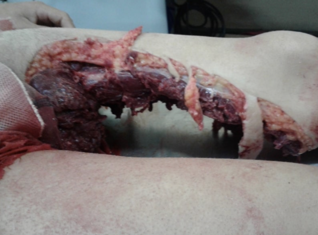 Los 5 ataques de tiburón más salvajes registrados en la historia (imágenes sensibles) 9 Captura de pantalla 2019 07 18 a las 20.38.32