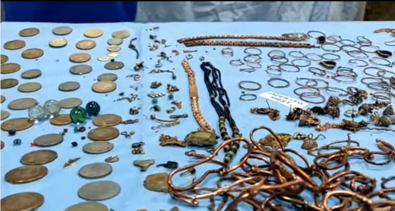 Extraen un kilo y medio de joyas del estómago de una mujer