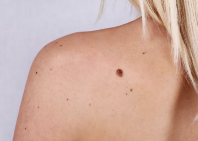 Captura de pantalla 2019 08 13 a las 10.09.37