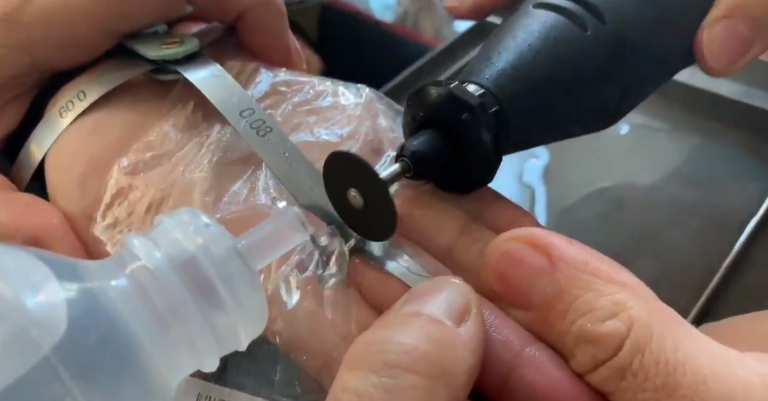 Solicita la ayuda de los Bomberos de Madrid para que le extraigan un anillo de su dedo hinchado