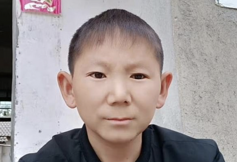 Una pedrada en la cabeza le hace tener aspecto de joven eternamente