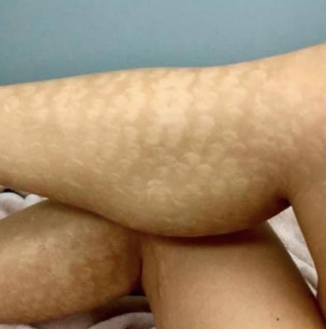 Arruina su carrera como 'stripper' tras someterse a una desastrosa depilación de 5.000 dólares 20 Captura de pantalla 2019 11 22 a las 14.55.17