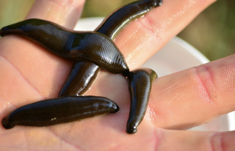 Descubren dos sanguijuelas en la garganta y en la nariz de un hombre que no dejaba de toser