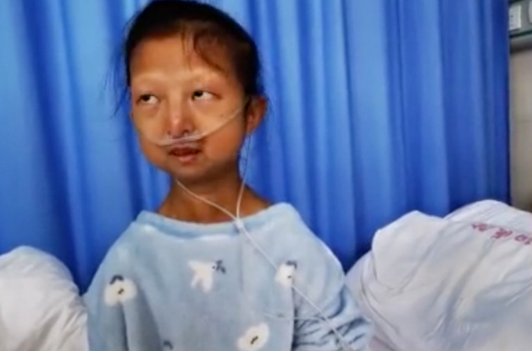 Una joven que se alimentó durante cinco años únicamente con arroz y chiles desata la polémica en China