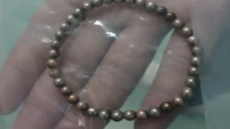 Extraen 37 imanes del cuerpo de un niño de tres años