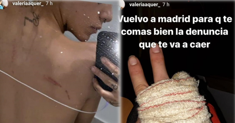 La hermana de Diana Quer denuncia haber recibido una paliza de su exnovio