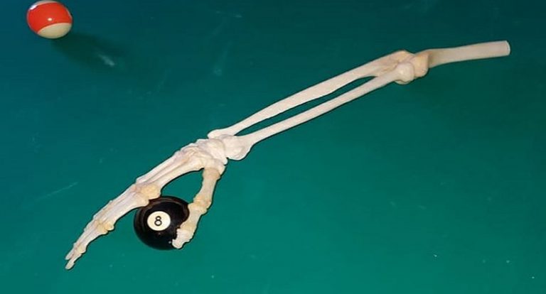 Imágenes sensibles: un hombre conserva como adorno su brazo amputado