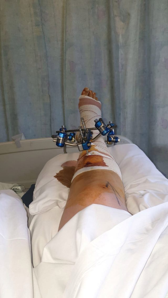 Una azafata se rompe la pierna en siete partes durante las turbulencias en un vuelo 3 NINTCHDBPICT000550066211