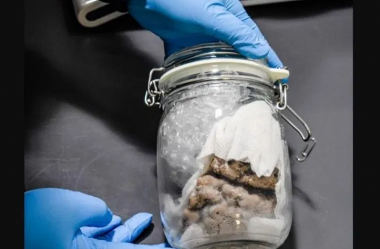 Interceptan un cerebro humano en un envío de paquetería