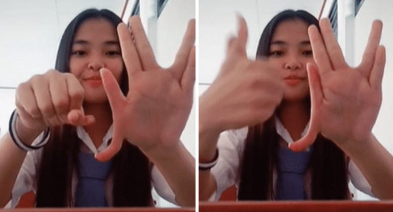 Una joven con dos pulgares en cada mano se viraliza en Tik Tok