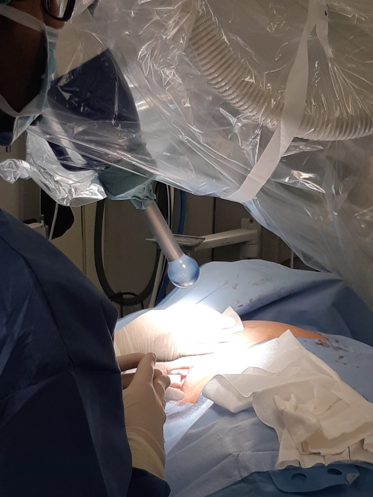 1.100 € es el coste medio para un paciente que necesite recibir radioterapia