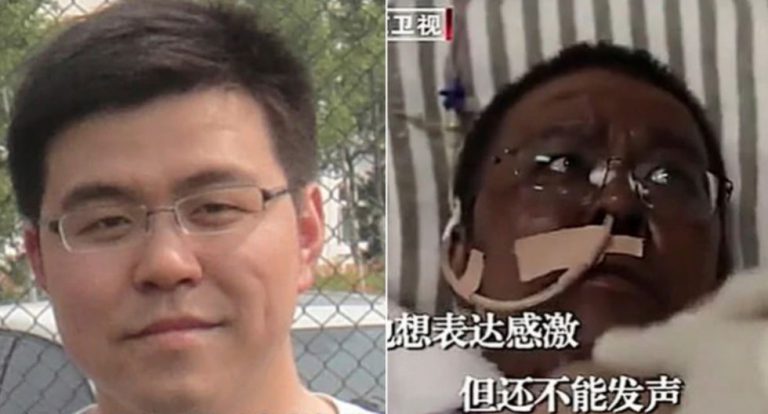 Dos médicos que atendieron a pacientes de coronavirus en Wuhan sufren drásticos cambios en el color de su piel