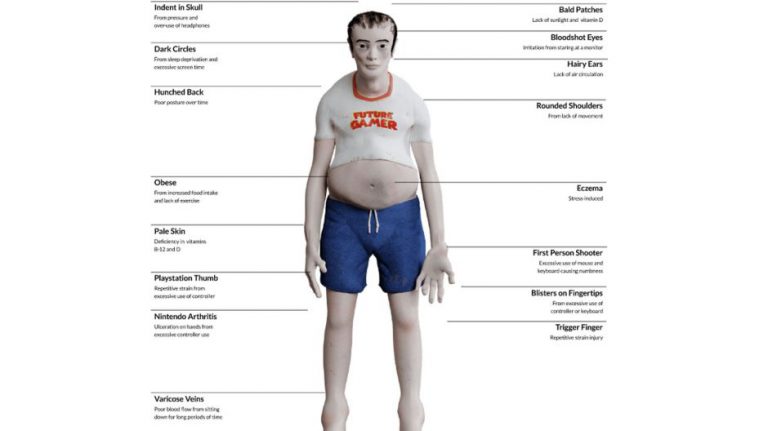 Gordos, jorobados y sin pelo: así serán los gamers en 20 años