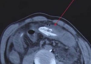 3D574AA6 DDCC 4CE2 AB28 4A143031CDC6