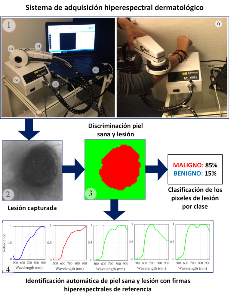 Investigadores del IUMA de la ULPGC crean una instrumentación hiperespectral no invasiva capaz de diagnosticar el cáncer de piel
