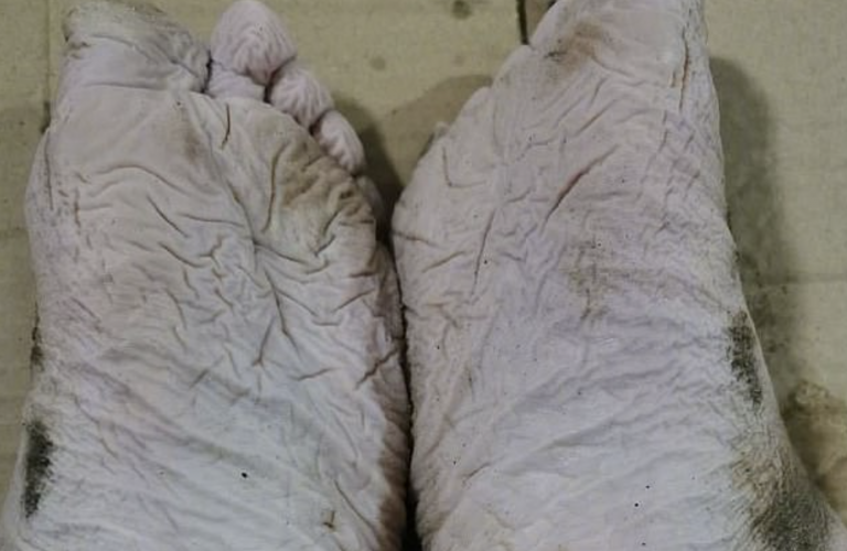 Un bombero comparte las fotos de sus pies tras trabajar durante 30 horas empapado en el barro