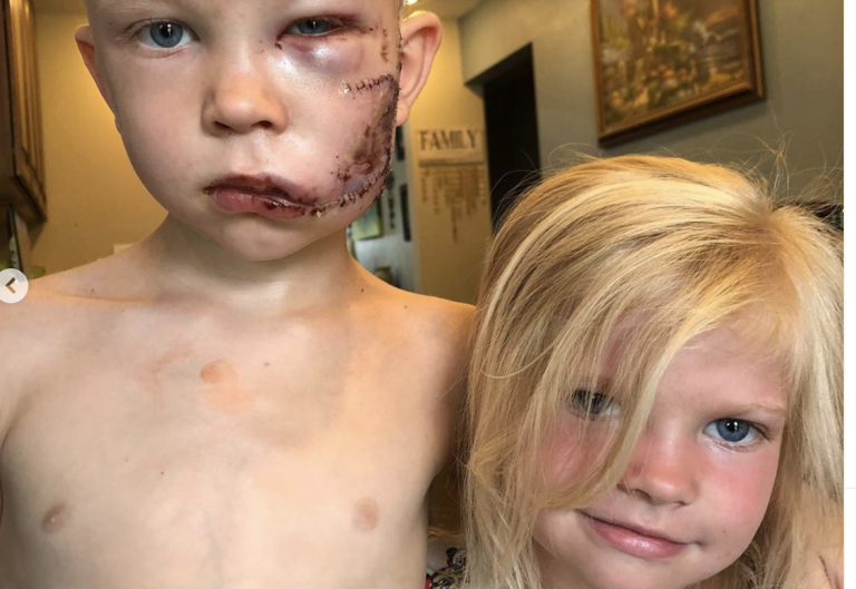 Un niño de 6 años se juega la vida y salva a su hermana del ataque de un perro