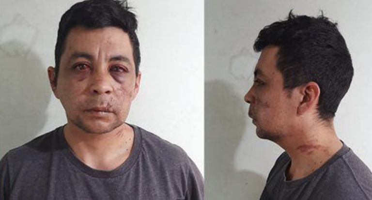 Regresa a su barrio tras haber pasado el coronavirus y sus vecinos le reciben a puñetazos, le queman la casa y le roban el coche