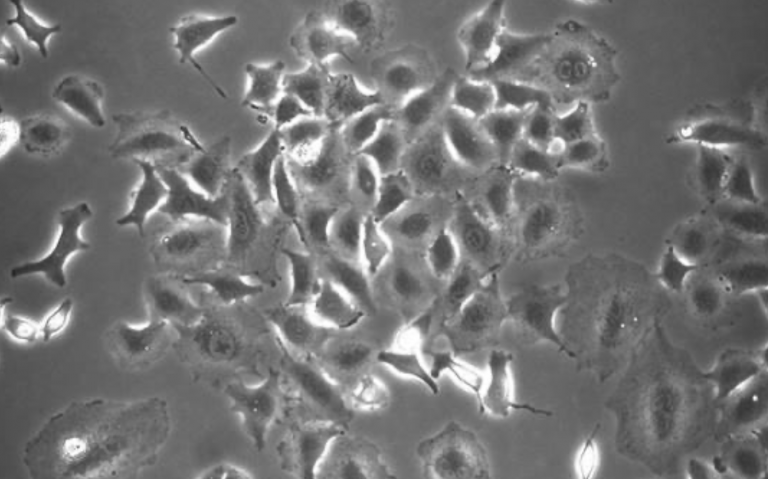 Prueban fármacos usados contra el cáncer para frenar la infección por coronavirus