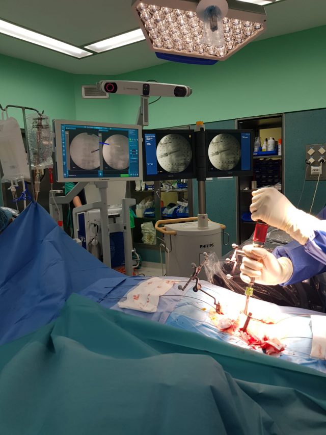 Intervención columna con navegador HUC