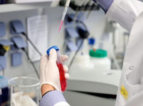 20200619091852_vacuna-coronavirus-efe_amp_w1200