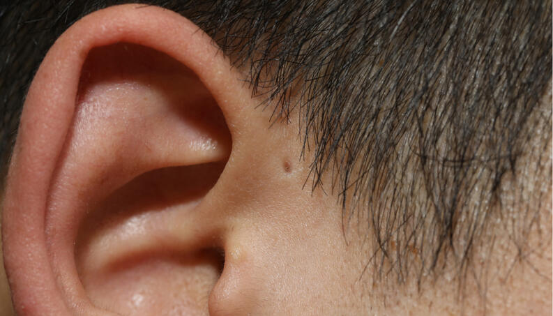agujeros-oreja