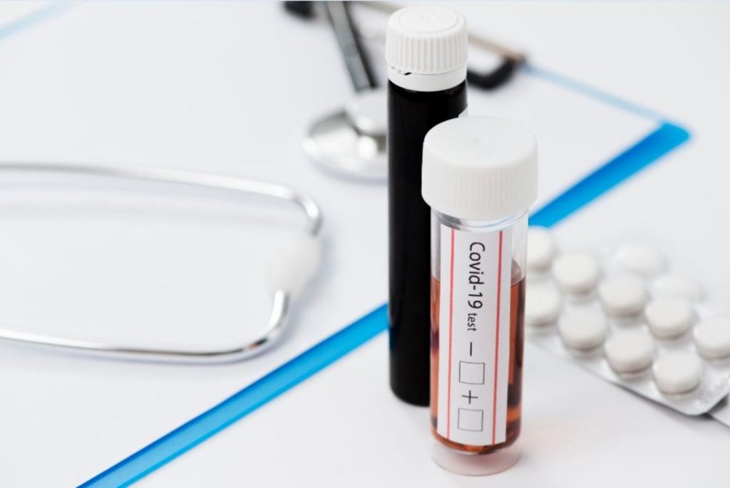 El test para la Covid-19 que puedes hacer en casa: cómo es, dónde comprarlo y cuánto vale 1 El test para la Covid-19 que puedes hacer en casa: cómo es, dónde comprarlo y cuánto vale