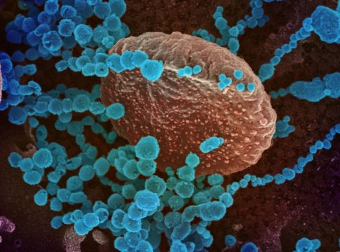 el-hospital-virgen-de-las-nieves-granada-ensayara-con-ductfit-contra-el-covid-19 El Virgen de las Nieves de Granada ensaya con humanos la tecnología anti Covid-19