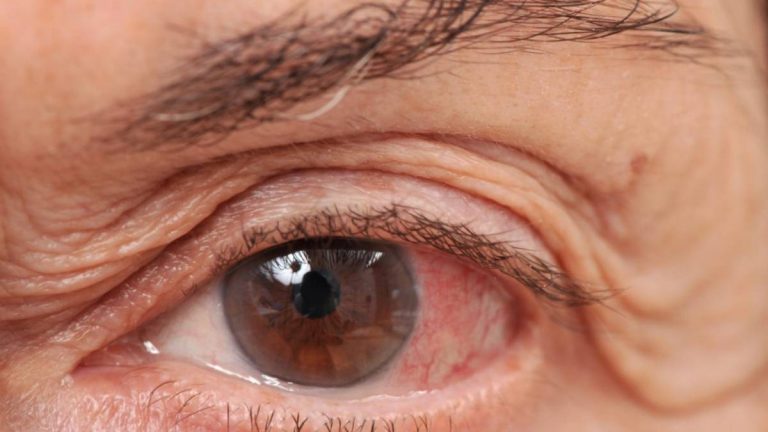 Investigadores del Centro Príncipe Felipe avanzan en un nuevo enfoque molecular y celular para el glaucoma