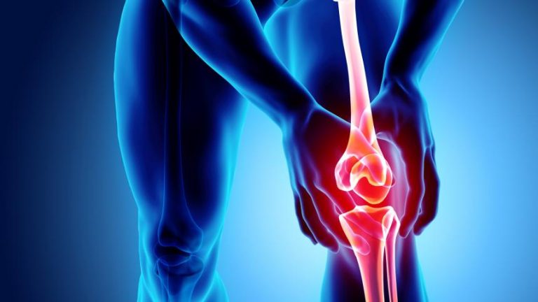 El ejercicio exigente es seguro para las personas con alto riesgo de artrosis de rodilla, según un estudio