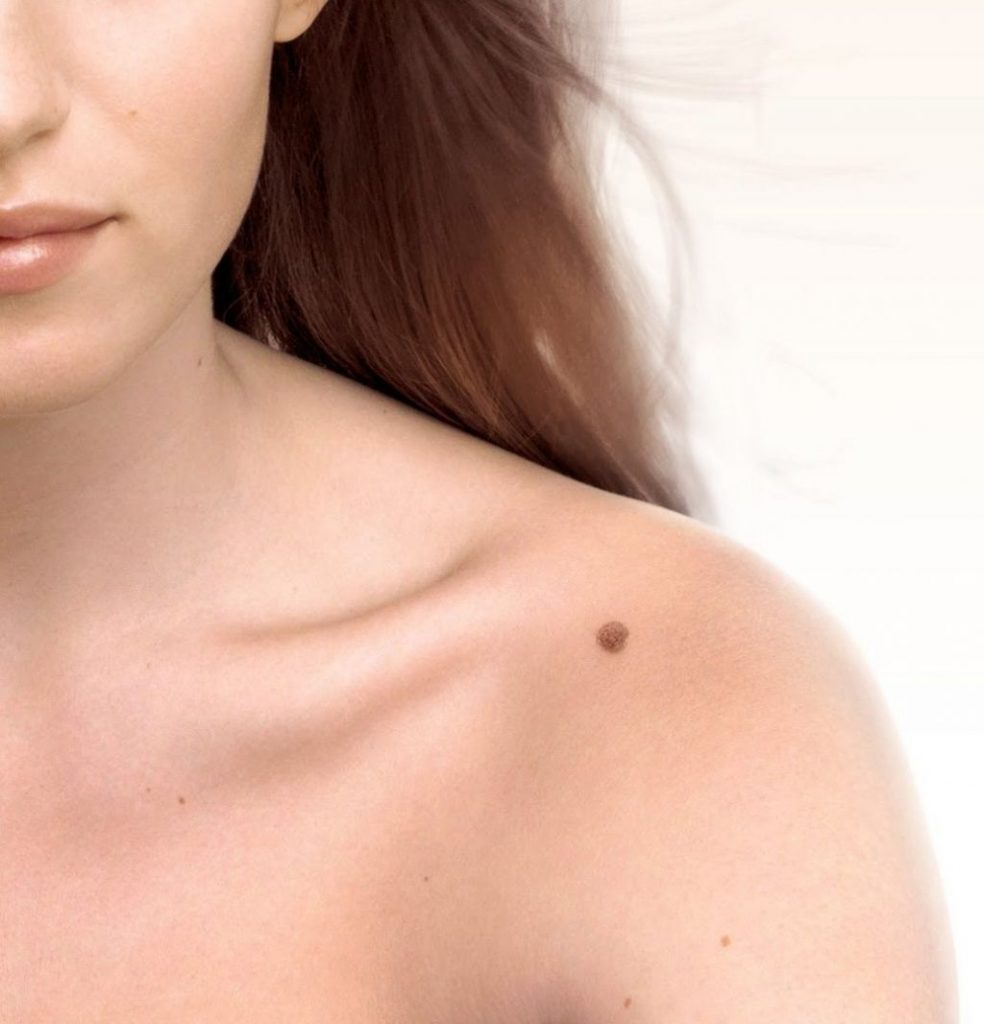 Síntomas que podrían estar avisándote de un cáncer y a los que no prestas atención 10 lunar-cancer