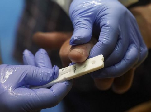 sanidad-aconseja-ccaa-tener-stock-suficiente-pruebas-covid-19