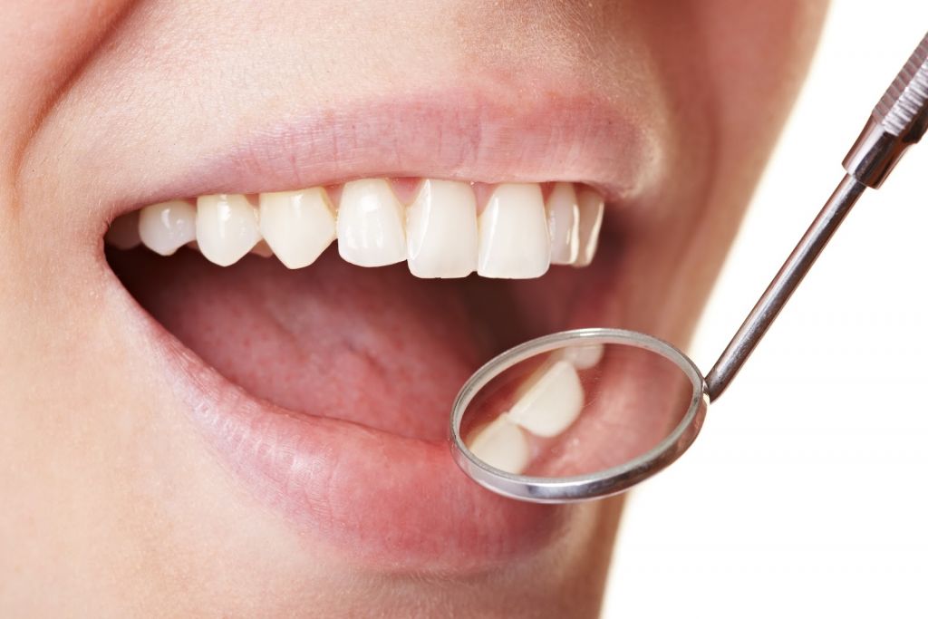 placa en los dientes
