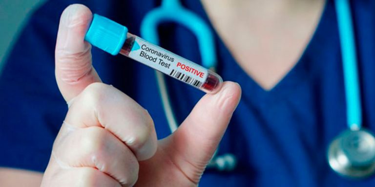 La Comunidad de Madrid notifica 2.731 casos nuevos y 34 fallecidos