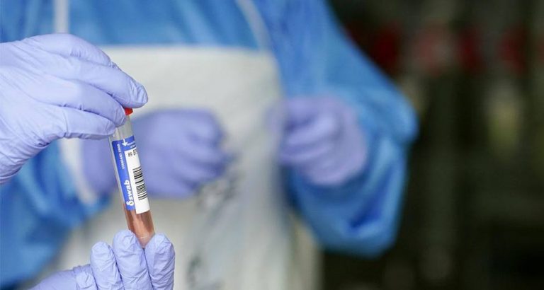 Aragón notifica 496 nuevos casos y la tasa de positividad es del 19,12%