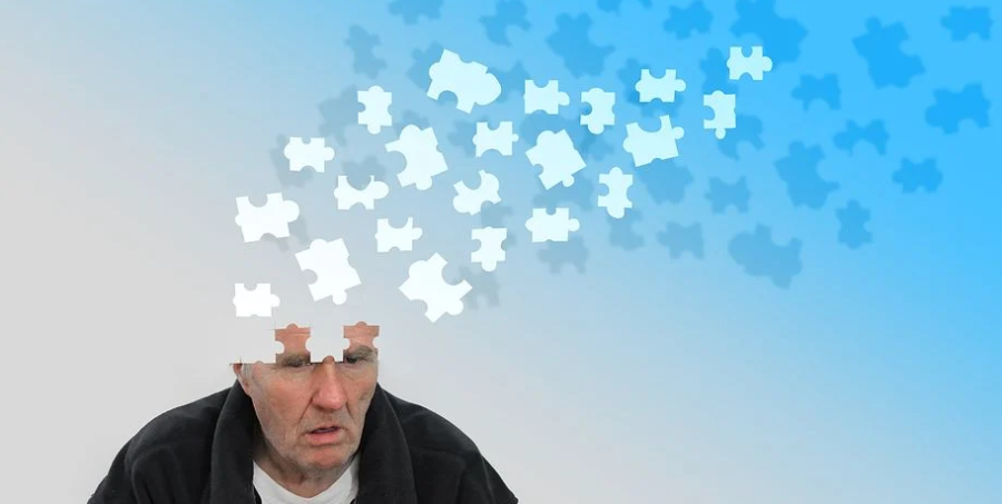 alzheimer