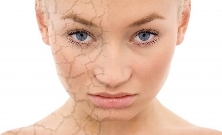 De esta manera afecta una mala alimentación a tu piel