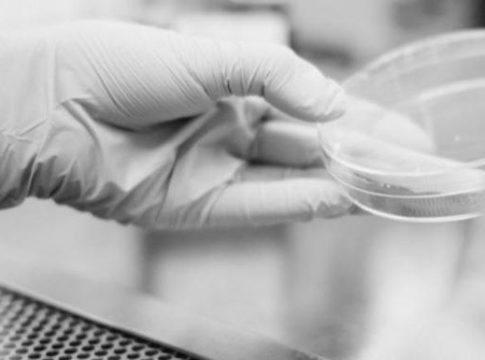 Qué es una PCR Qué es una PCR