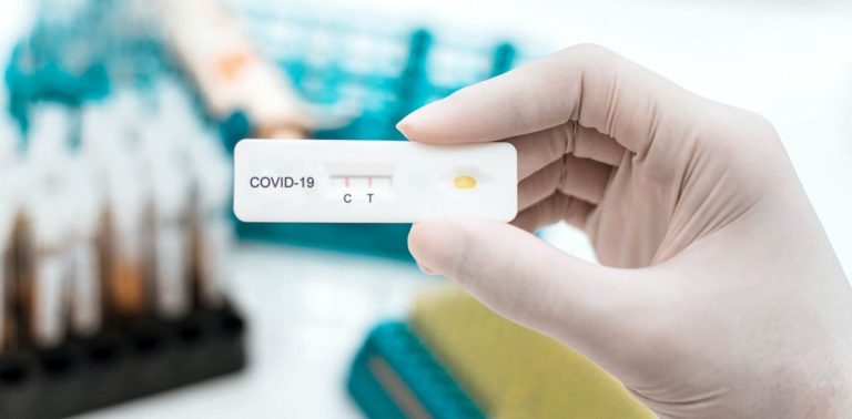 Galicia recurrirá a farmacéuticos para que hagan test de antígenos