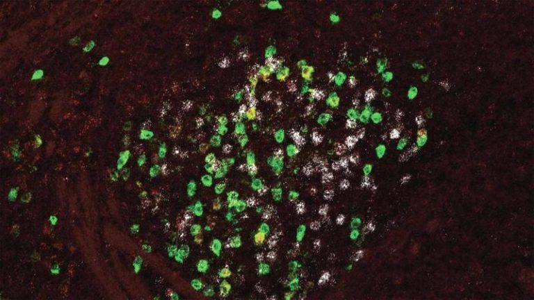 Un estudio halla un circuito en el cerebro que podría estar relacionado con el miedo