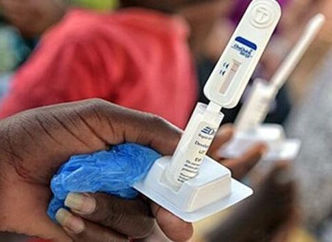 Hasta 136.000 personas fueron diagnosticadas con VIH en Europa en 2019 Hasta 136.000 personas fueron diagnosticadas con VIH en Europa en 2019