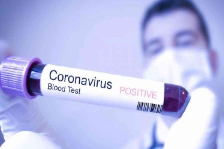 Suben a 446 los positivos en residencias gallegas