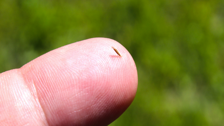 Cómo sacar una espina