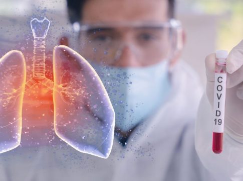 Coronavirus Coronavirus