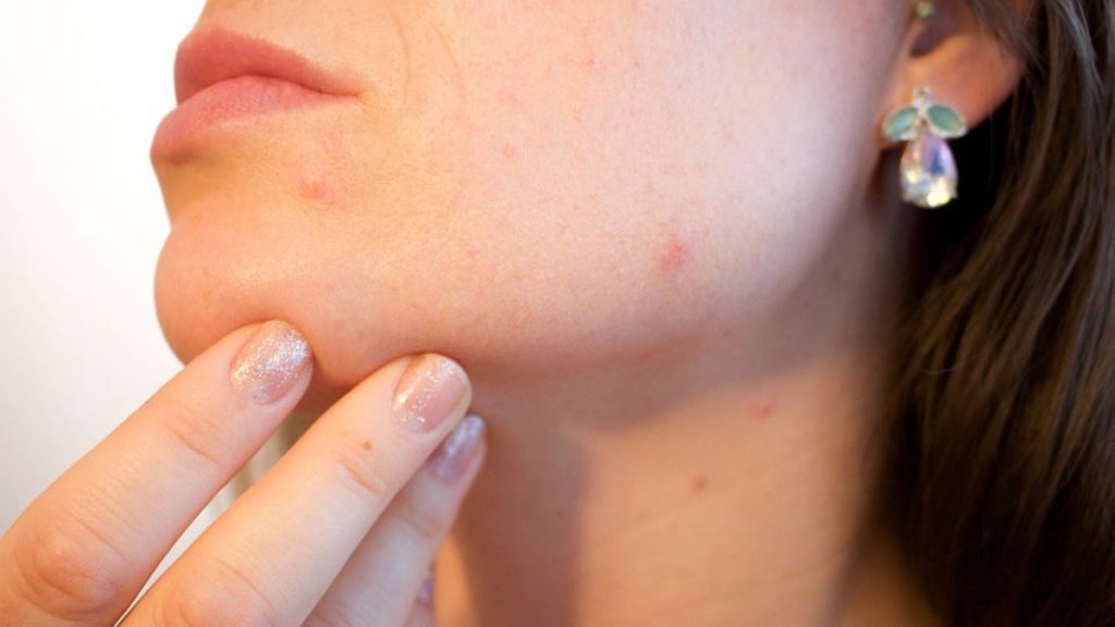 Sífilis, clamidia... las enfermedades de transmisión sexual más chungas